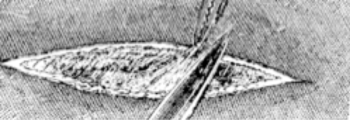 1906