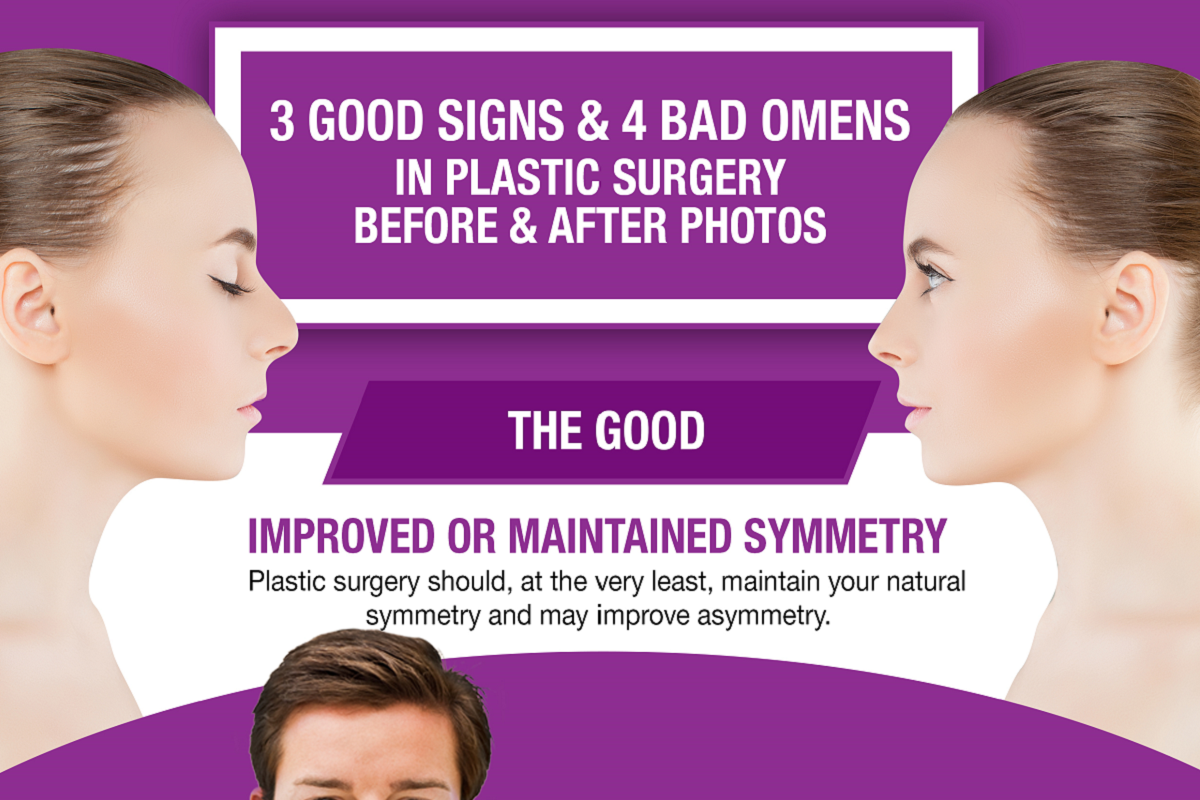 3 Good Signs & 4 Bad Omens in Plastic Surgery Before & After Photos [Infographic]