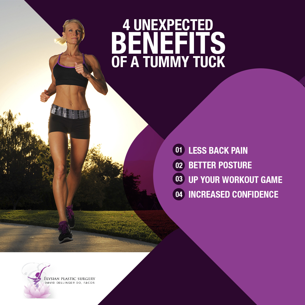 4 Unexpected Benefits of a Tummy Tuck [Infographic]